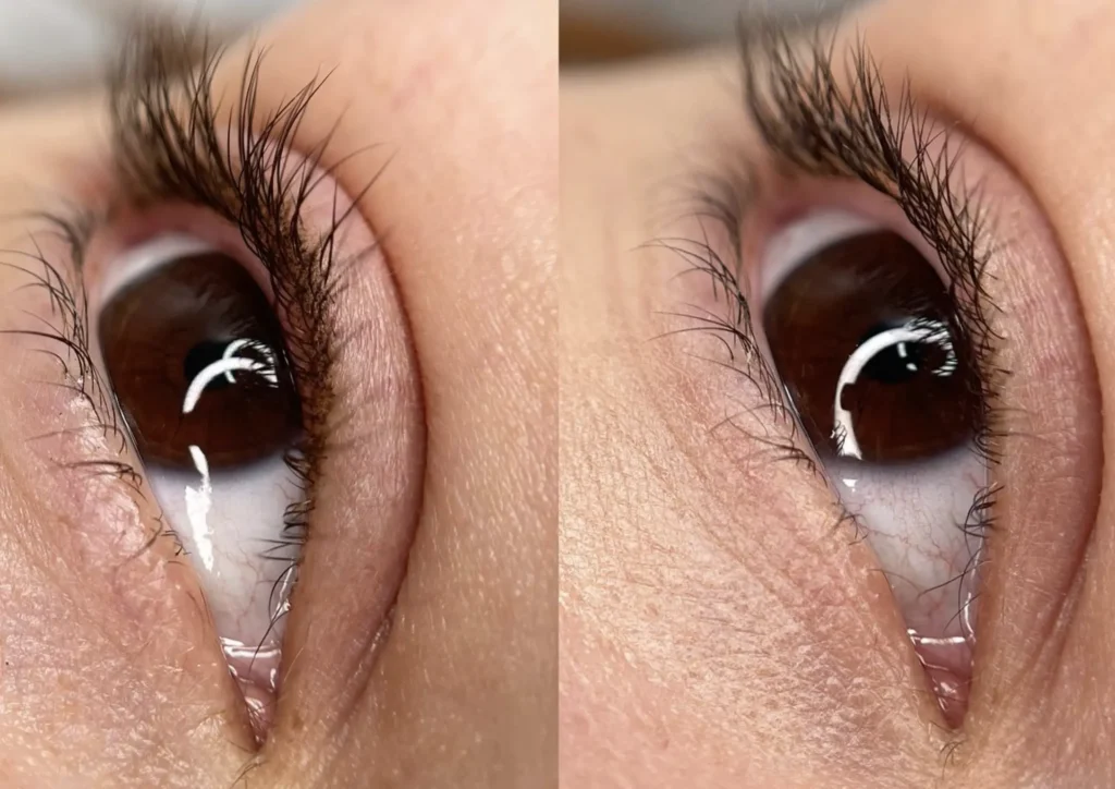 cosmetic tattooing